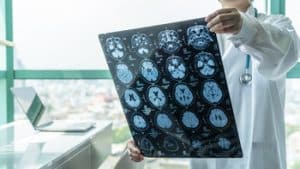 Atlanta traumatic brain injury