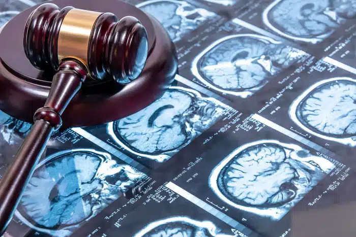 hire brain injury lawyer in Atlanta